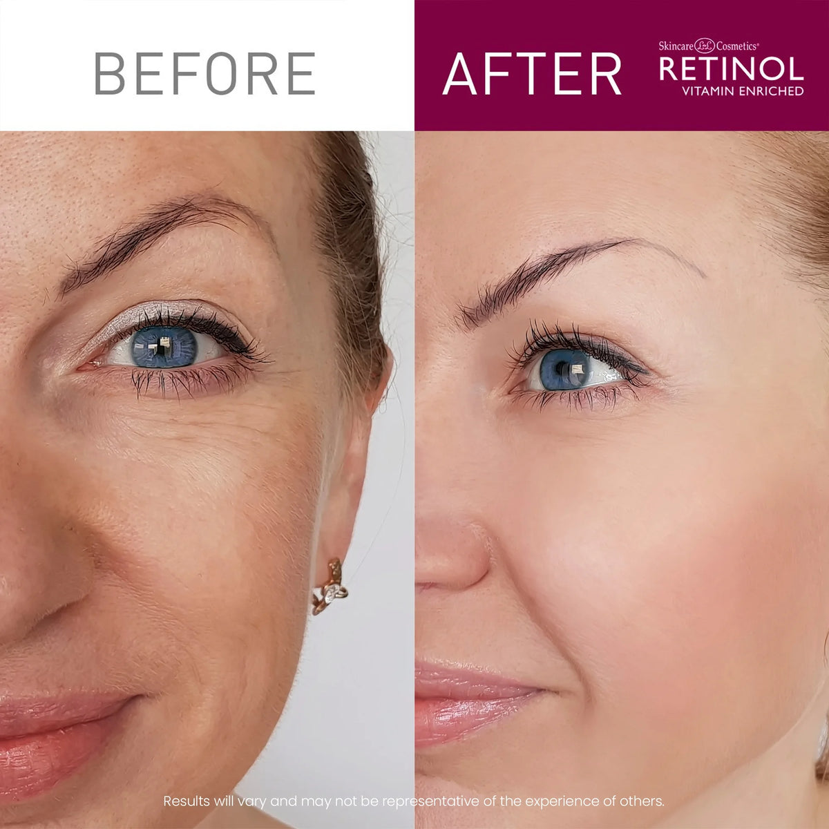Retinol 6X Super Retinol Serum U525